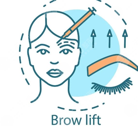 金奇龍醫(yī)生提眉手術案例