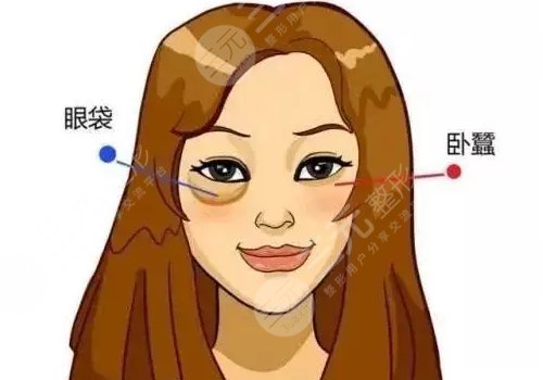 衡陽(yáng)雅美醫(yī)療美容醫(yī)院去眼袋怎么樣