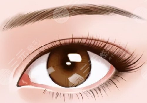 西安李學(xué)擁雙眼皮割的好嗎