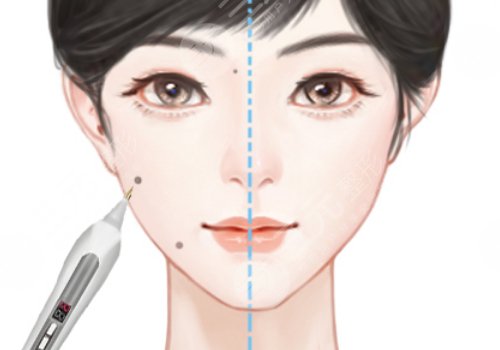 汕頭市中心醫(yī)院美容科 點痣怎么預(yù)約