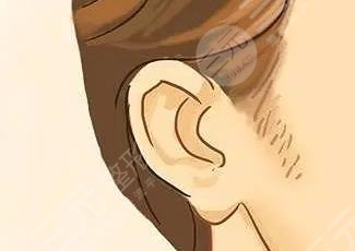 鬢角毛發(fā)種植