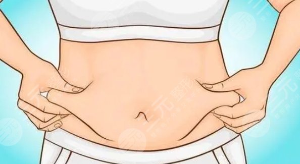 肚子環(huán)吸脂
