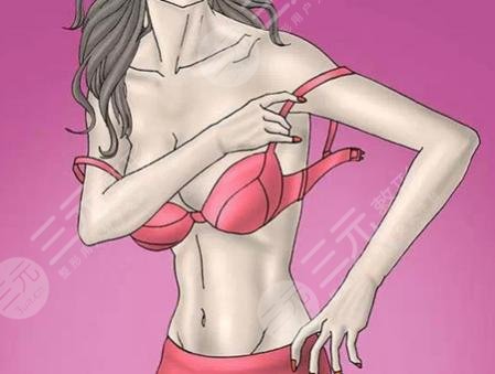 瀘州醫(yī)學(xué)院附屬醫(yī)院整形美容科假體隆胸案例