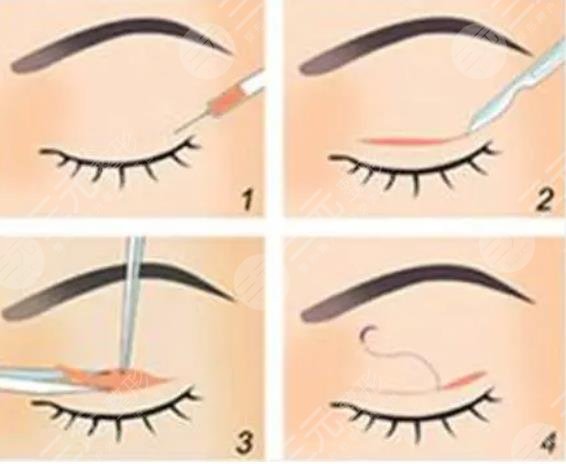 上海第九人民醫(yī)院整復(fù)外科特色項目