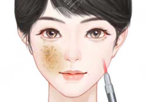 汕頭市中心醫(yī)院祛斑價格