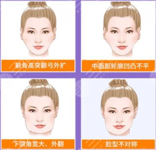 顴骨磨骨手術(shù)過程科普！頜面整形不簡單，術(shù)前知識(shí)點(diǎn)掃盲！