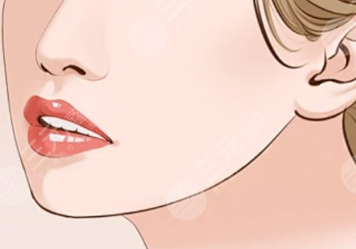 下顎線整形多少錢(qián)