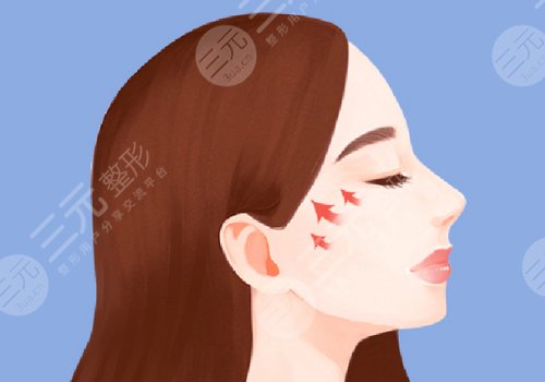 顴骨手術(shù)費(fèi)用一般多少