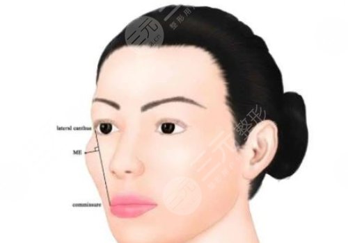 顴骨手術(shù)費(fèi)用一般多少