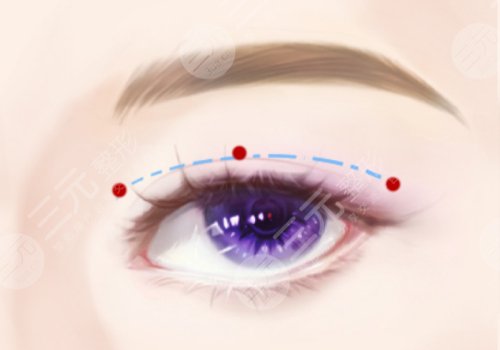 許宏權(quán)醫(yī)師醫(yī)術(shù)怎么樣