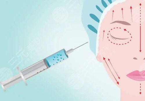 汕頭可德醫(yī)療美容診所玻尿酸怎么樣