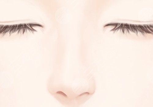 佛山美萊醫(yī)療美容醫(yī)院做鼻子多少錢