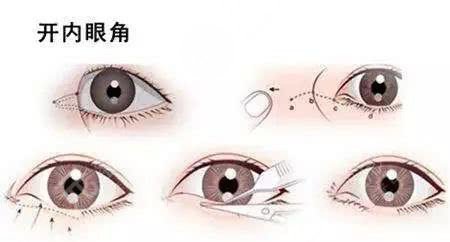 上海九院王業(yè)飛醫(yī)生怎么掛號(hào)