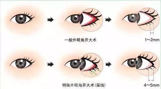 上海九院王業(yè)飛醫(yī)生怎么掛號(hào)