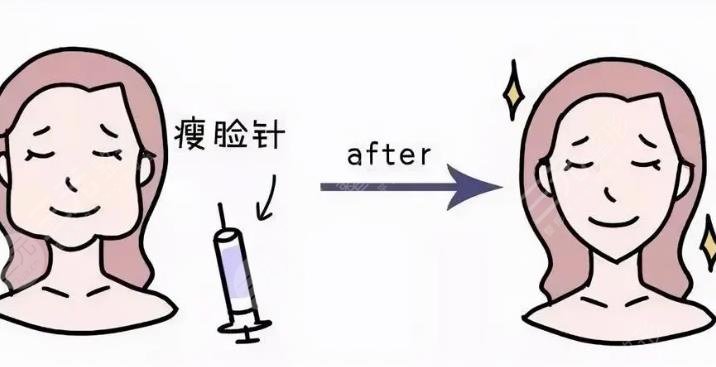注射瘦臉