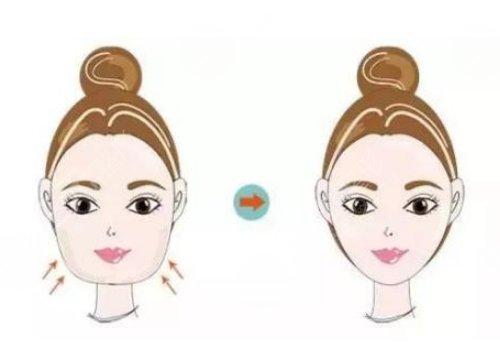 下頜骨整形術(shù)一般費用