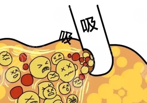 做一次醫(yī)美大概多少錢