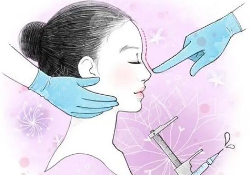 隆鼻想長久建議硅膠還是膨體