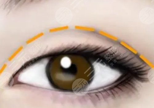 譚鶩遠和方柏榮