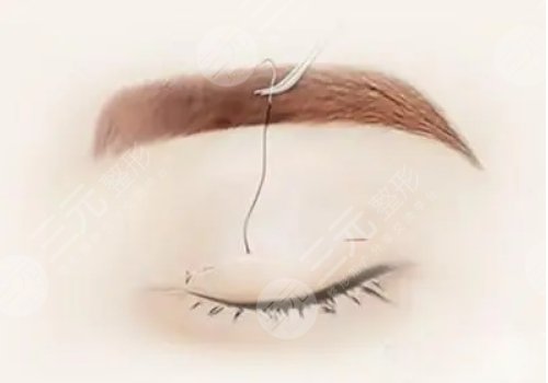 董棟醫(yī)生縫合技術(shù)怎么樣了