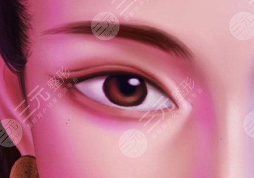 冷向峰開(kāi)眼角