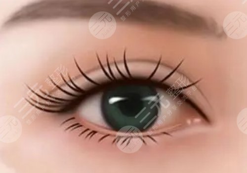 雙眼皮修復時間是什么時候