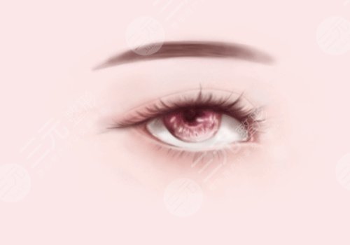 雙眼皮修復時間是什么時候