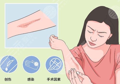 青島大學(xué)附屬醫(yī)院整形科疤痕植皮修復(fù)