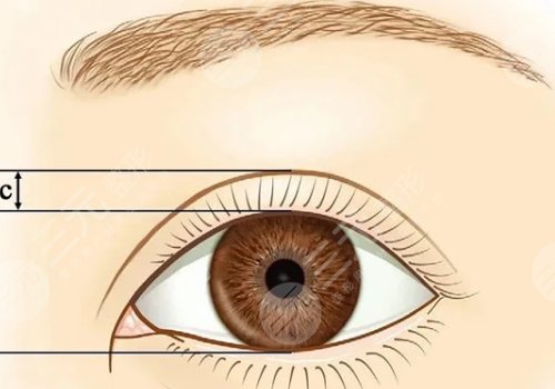 蕪湖弋磯山醫(yī)院隆胸多少錢
