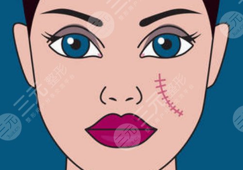 蘇州附二院祛疤多少錢