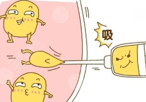 蕪湖弋磯山醫(yī)院吸脂怎么樣