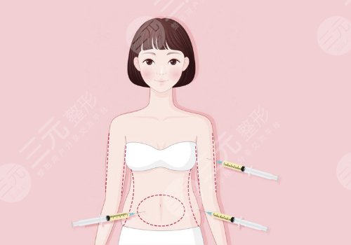 吸脂瘦腰有哪些方法