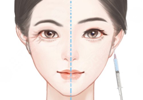 輕醫(yī)美有風(fēng)險(xiǎn)嗎