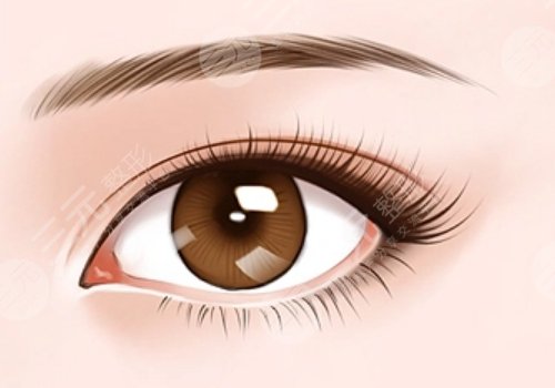 割雙眼皮第七天恢復(fù)圖