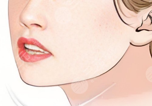 左右下頜骨不對稱怎么矯正