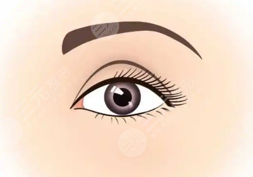 埋線雙眼皮一個寬一個窄怎么修復