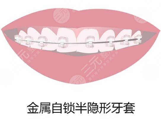 蕭山第一人民醫(yī)院牙科價格貴不貴?