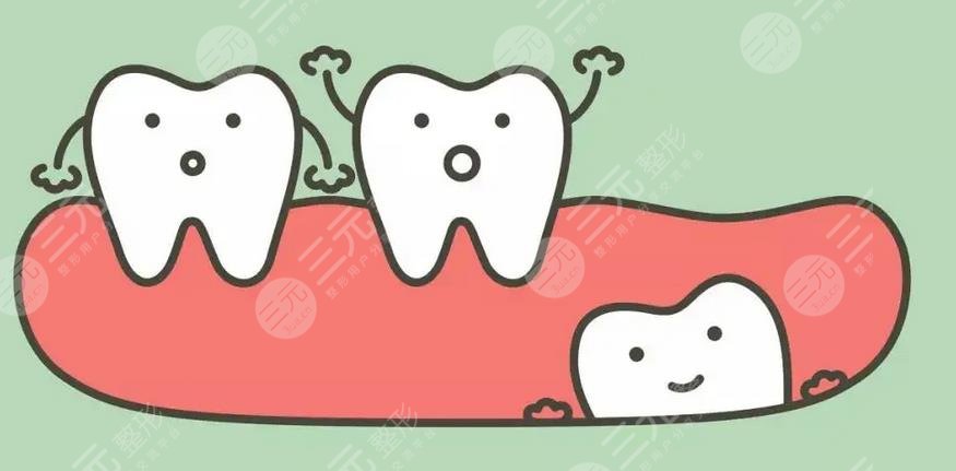 南京(江蘇)省人民醫(yī)院種植牙收費標準
