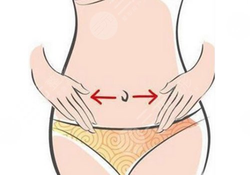 成都怡脂醫(yī)療正規(guī)嗎