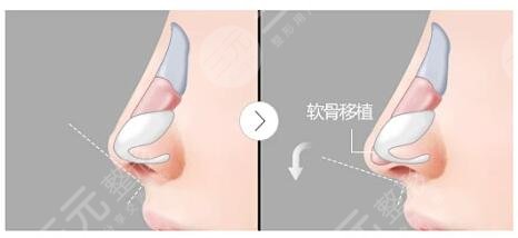 上海國際醫(yī)學(xué)中口碑點評