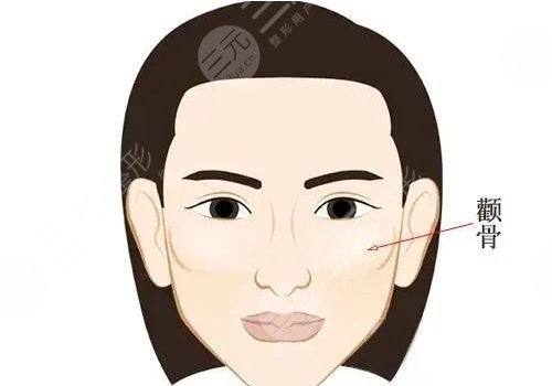 顴骨內(nèi)推怎么做