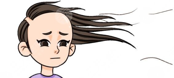 發(fā)際線種植