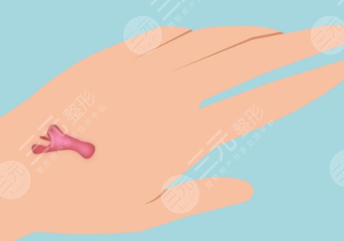 河南中醫(yī)藥大學(xué)第一附屬醫(yī)院整形外科瘢痕疙瘩