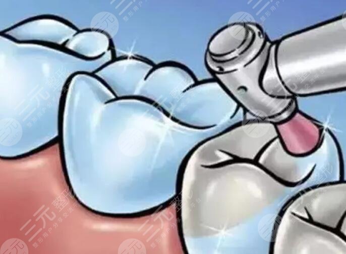 補(bǔ)牙