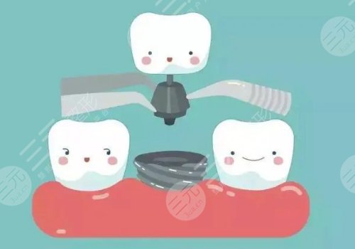 蘇大附一院看牙怎么樣