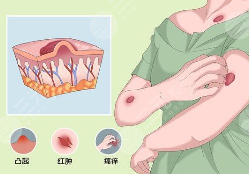 章一新疤痕怎么樣