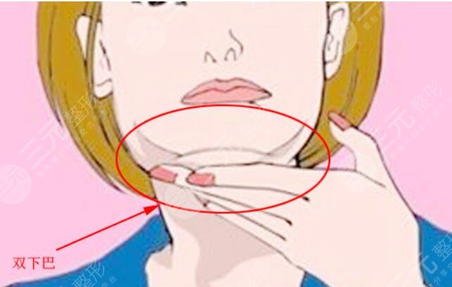 鉆石超塑下頜緣