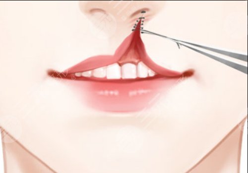 章建林做唇腭裂好嗎