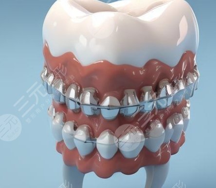牙齒矯正