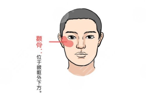 張笑天做顴骨怎么樣